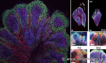 Lab-grown 'mini brains' are developed from the cells of dementia and motor neurone patients