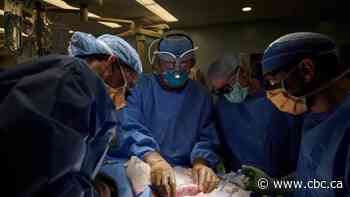 Surgeons attach pig kidney to cadaver in effort to develop animal organs for transplant use