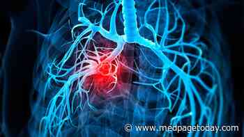 NSCLC Incidence Declining, Except in Stage I Disease