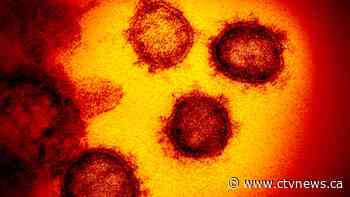 Coronavirus: A woman had COVID-19 for a year - CTV News