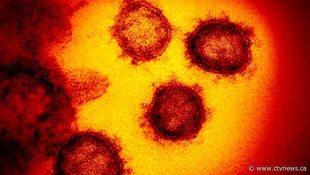 An American woman had COVID-19 for a year. This is what doctors learned