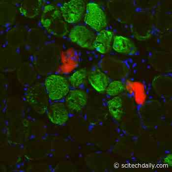 Rapid New Mechanism for Muscle Self-Repair Independent of Stem Cells