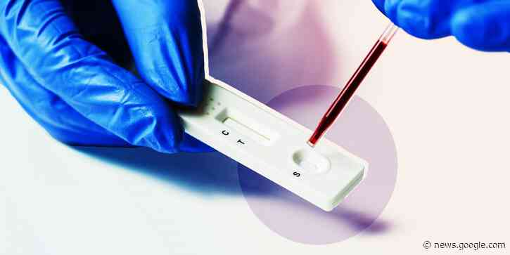 Who Should Get an Antibody Test for COVID-19? What Doctors Advise | Health.com - Health.com