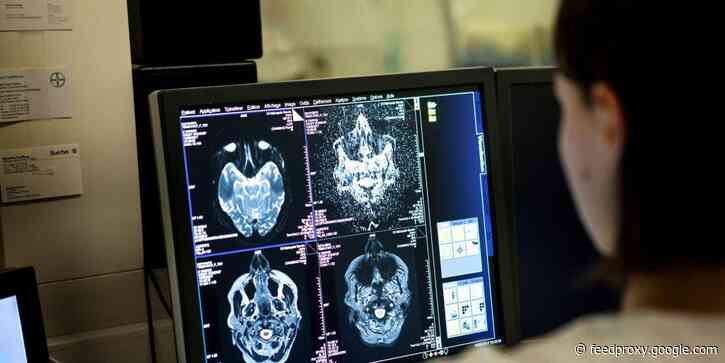 New study finds that COVID-19 can damage brain cells, impairing cognitive function