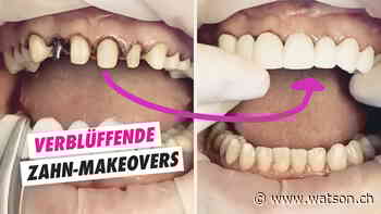 Dieser Zahnarzt zeigt Vorher-Nachher-Bilder, die einfach nur verblüffen - watson