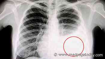 What Is the Cause of Persistent Pleuritis in Lung Cancer Patient?