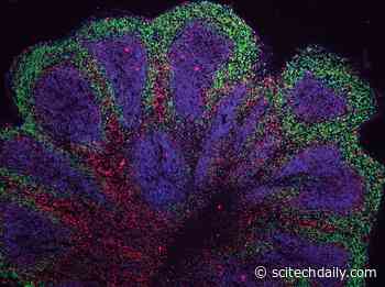 Scientists Grow “Mini Brains” in the Lab – Find Potential Treatment Path for Fatal Neurological Disease