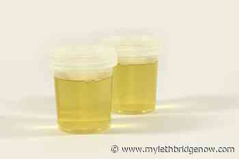 University of Lethbridge study uses urine analysis to diagnose concussions - My Lethbridge Now