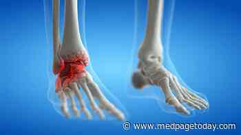 No Love for PRP in Ankle Osteoarthritis Trial