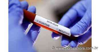 Chega a 108 os mortos pela Covid-19 em Imbituba; Prefeitura confirmou que óbito de morador de Vila Nova foi em decorrência da doença - Portal AHora