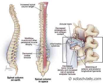 Astronauts Often Experience Back Pain – Leading to Treatment Insights for Those of Us on Earth