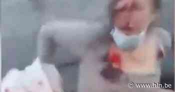 Beelden tonen zwaargewonde vrouw bij incident op bus - Het Laatste Nieuws