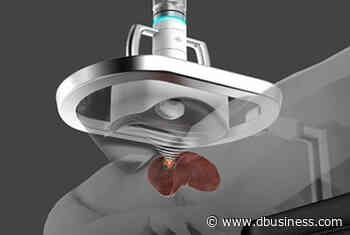 HistoSonics Receives FDA Designation for Sonic Beam Therapy - dbusiness.com