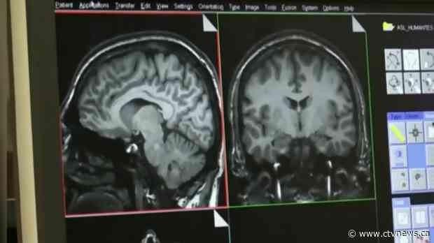 Patients and families tied to potential mystery brain disease speak out about neurologist Dr. Marrero