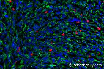 Resistance to Cancer Therapy Determined by Differences in T Cells’ Functional State