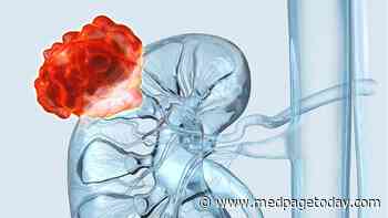 RCC After Kidney Transplantation From Live Donor
