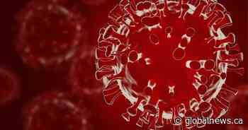 COVID-19: Saskatchewan reports 107 new infections, adds 5 deaths