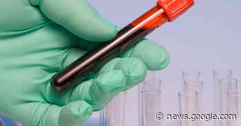 New blood test can spot more than 50 types of cancer – many hard to detect early - CBS News