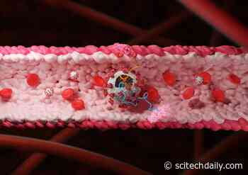 Researchers Identify Proteins in the Coronavirus That Can Damage Blood Vessels - SciTechDaily