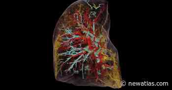 World's brightest X-rays usher in medical imaging revolution - New Atlas