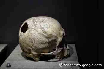 Ancient Medical Treatments Still Used Today