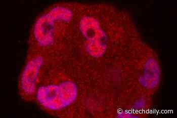 New RNA Strategy Against Treatment-Resistant Prostate Cancer Identified