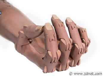 How to 3D print a child's arm