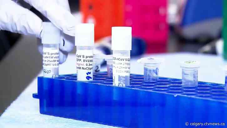 COVID-19 ranked among leading causes of death in Alberta, far outpacing last year’s fatalities