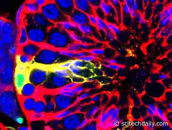 Reproductive Sciences Experts Discover Gene Crucial to Sperm Cell Production