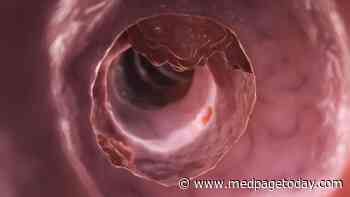 Early-Onset Colorectal Cancer on the Rise in Whites, Stable in Blacks