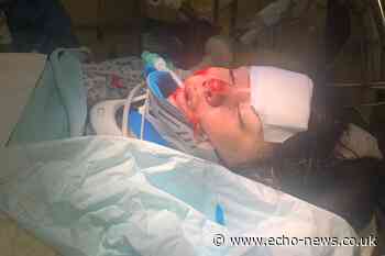 Basildon: Man released after girl hit by car in Langdon Hills | Echo - Echo