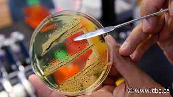 Health officials investigating salmonella outbreaks in B.C., Alberta, Saskatchewan and Manitoba