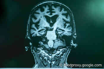 The Origins and Young History of Early-Onset Alzheimer’s Disease