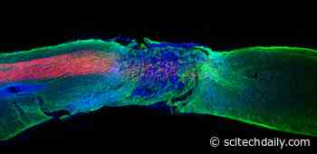 Regenerative Medicine Breakthrough: “Dancing Molecules” Successfully Repair Severe Spinal Cord Injuries