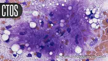 Chemo-ICI Combo Promising in Soft Tissue Sarcoma