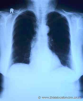 Man's wife picked up on warning signs of lung cancer