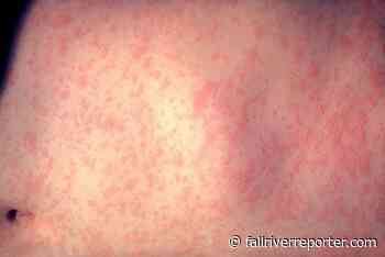 CDC and WHO have concerns of measles outbreak amid pandemic - Fall River Reporter