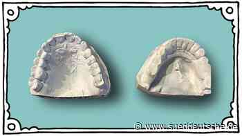 Essen: Polizei stoppt rollendes Auto mit Zahnabdrücken - Panorama - SZ.de - Süddeutsche Zeitung - SZ.de