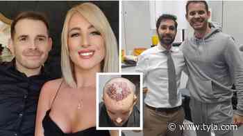 Married At First Sight UK Star Luke Dawson Shares Pictures Of Dramatic Hair Transplant Procedure - Tyla