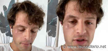 Iconize, Marco Ferrero ex fidanzato di Tommaso Zorzi / Il rapporto con Soleil Sorge - Il Sussidiario.net