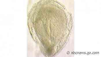 New research offers glimpse into early human development