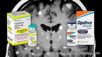 Immunotherapy Combo Produces Durable Responses in Melanoma Brain Metastases