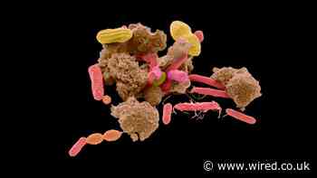 The Gut Microbiome’s Role in Autism Gets Murkier