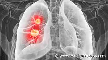Immunotherapy-Based Regimen Boosts PFS in EGFR-Mutant Lung Cancer