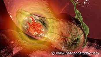'Actual' 5-Year Survival Rate of 27% After Surgery, Chemo for Pancreatic Cancer