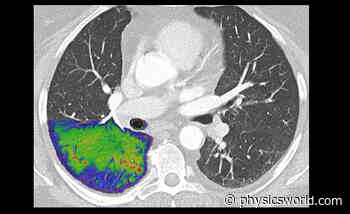 Photon-counting CT promises a new era of medical imaging – Physics World - Medical Physics Web