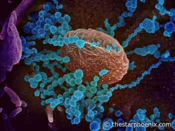 COVID-19: Saskatchewan's 62 new cases lowest since Aug. 9