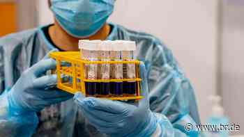 Labor für Corona-Tests in Passau arbeitet am Anschlag - BR24