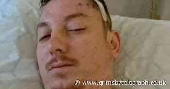 Man refused GP appointment and referred to Specsavers has terminal tumour - Grimsby Live