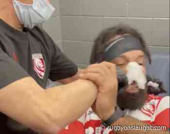 Doctor wrestles Gloucester man's nose back into place in graphic video - Rugby OnSlaught